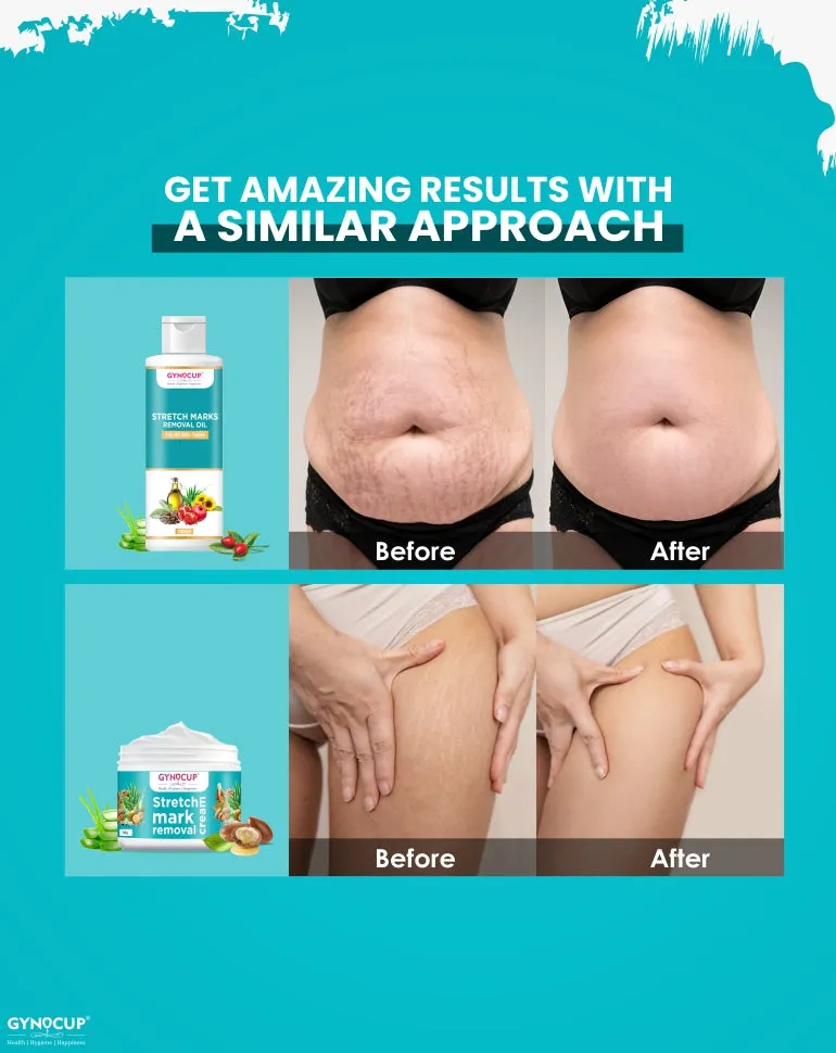 Natural Anti-Stretch Marks Kit